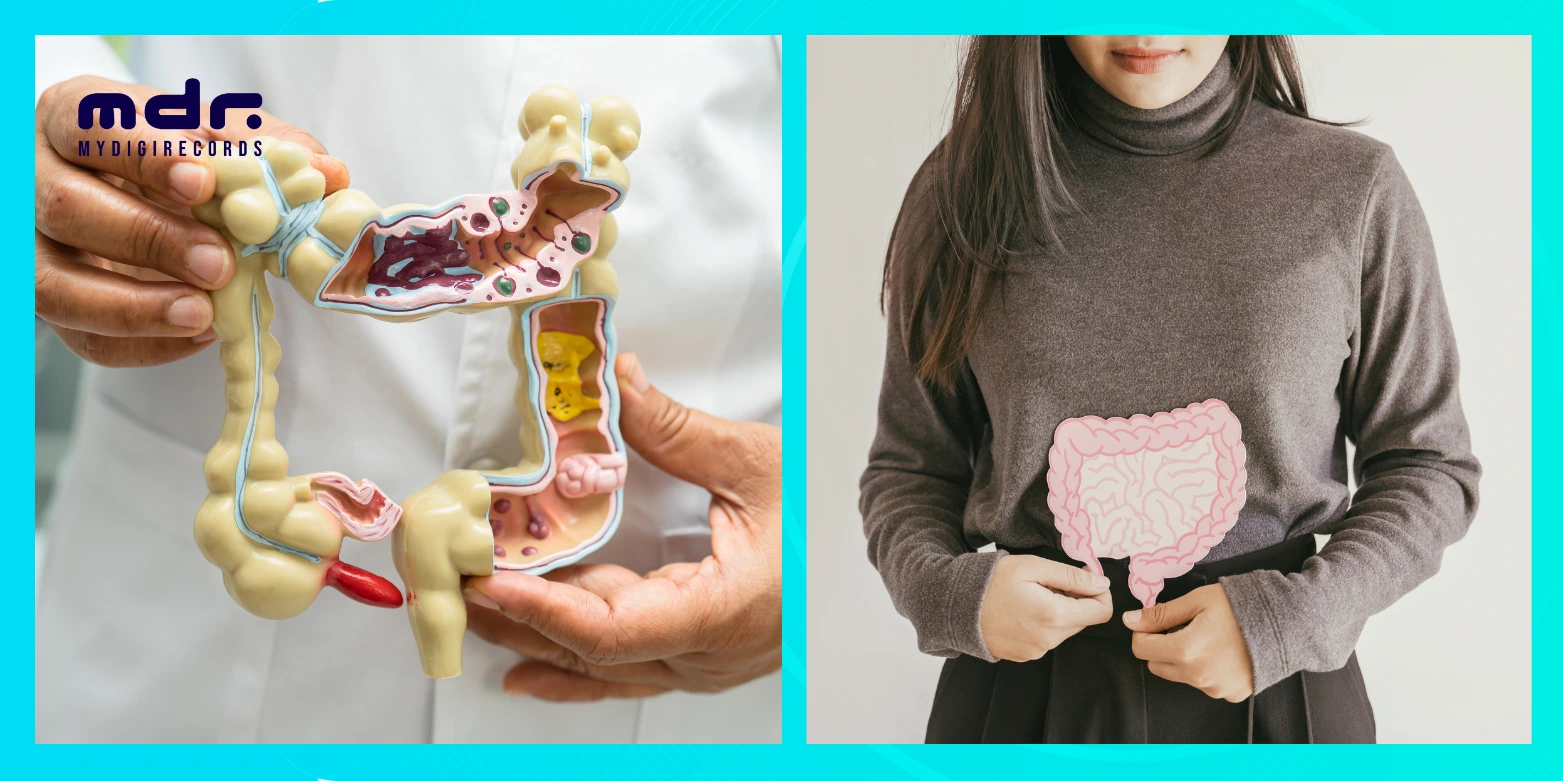 Gut Health Importance